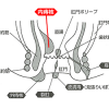 内痔核硬化療法