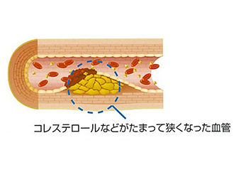 血管の様子