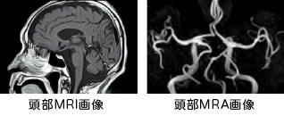 mri_left