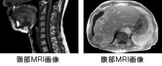 mri_right